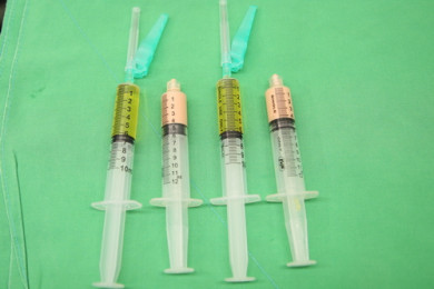 淺黃色為PRP、粉膚色為SVF